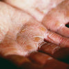5 Essential Tips To Care For Rough, Dry Hands